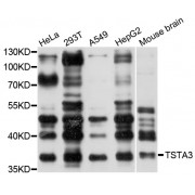 Western blot analysis of extracts of various cell lines, using TSTA3 antibody (abx003080) at 1/1000 dilution.