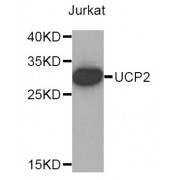 Western blot analysis of extracts of Jurkat cells, using UCP2 antibody (abx003088).