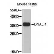Western blot analysis of extracts of mouse testis, using DNALI1 antibody (abx003099) at 1/1000 dilution.