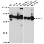 Western blot analysis of extracts of various cell lines, using SHOC2 Antibody (abx003107) at 1:3000 dilution.