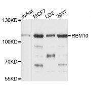 Western blot analysis of extracts of various cell lines, using RBM10 antibody (abx003115) at 1/1000 dilution.