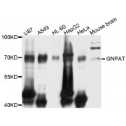 Western blot analysis of extracts of various cell lines, using GNPAT antibody (abx003124) at 1/1000 dilution.