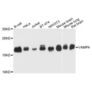 Western blot analysis of extracts of various cell lines, using VAMP4 antibody (abx003142) at 1/1000 dilution.