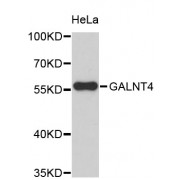 Western blot analysis of extracts of HeLa cells, using GALNT4 antibody (abx003143).