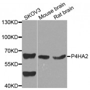 Western blot analysis of extracts of various cell lines, using P4HA2 antibody (abx003159) at 1/1000 dilution.