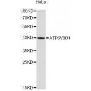 Western blot analysis of extracts of HeLa cells, using ATP6V0D1 antibody (abx003168) at 1/2000 dilution.