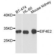 Western blot analysis of extracts of various cell lines, using EIF4E2 antibody (abx003198) at 1/1000 dilution.