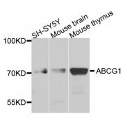 Western blot analysis of extracts of various cell lines, using ABCG1 antibody (abx003219) at 1/1000 dilution.