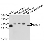 Western blot analysis of extracts of various cell lines, using EMG1 antibody (abx003301) at 1/1000 dilution.