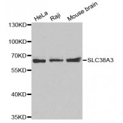 Western blot analysis of extracts of various cell lines, using SLC38A3 antibody (abx003345).