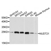 Western blot analysis of extracts of various cell lines, using NUDT21 antibody (abx003353) at 1/1000 dilution.
