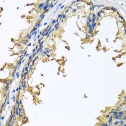 Neuroligin 4, Y-Linked (NLGN4Y) Antibody