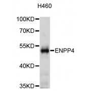 Western blot analysis of extracts of H460 cells, using ENPP4 antibody (abx003383) at 1:3000 dilution.