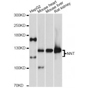 Western blot analysis of extracts of various cell lines, using NNT antibody (abx003424) at 1:3000 dilution.