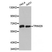 Western blot analysis of extracts of various cell lines, using TRIM29 antibody (abx003438).