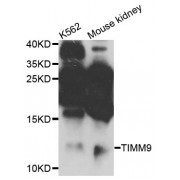 Western blot analysis of extracts of various cell lines, using TIMM9 antibody (abx003480) at 1/1000 dilution.