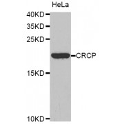 Western blot analysis of extracts of HeLa cells, using CRCP antibody (abx003510).