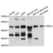 Western blot analysis of extracts of various cell lines, using PELO antibody (abx003613) at 1/1000 dilution.