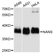 Western blot analysis of extracts of various cell lines, using NANS antibody (abx003615) at 1:3000 dilution.