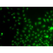Immunofluorescence analysis of A549 cells using IWS1 antibody (abx003668).