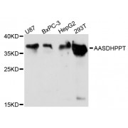 Western blot analysis of extracts of various cell lines, using AASDHPPT antibody (abx003732) at 1:3000 dilution.