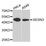 Western blot analysis of extracts of various cell lines, using SESN3 antibody (abx003957) at 1/1000 dilution.