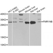 Western blot analysis of extracts of various cell lines, using FMR1NB Antibody (abx003975) at 1/1000 dilution.