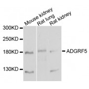 Western blot analysis of extracts of various cell lines, using ADGRF5 antibody (abx003994) at 1/1000 dilution.