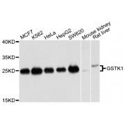 Western blot analysis of extracts of various cell lines, using GSTK1 antibody (abx004014) at 1/1000 dilution.