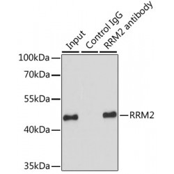 Ribonucleoside-Diphosphate Reductase Subunit M2 (RRM2) Antibody