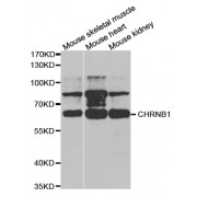 Western blot analysis of extracts of various cell lines, using CHRNB1 antibody (abx004045) at 1/1000 dilution.