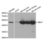 Western blot analysis of extracts of various cell lines, using ABAT antibody (abx004049) at 1/1000 dilution.
