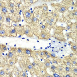 4-Aminobutyrate Aminotransferase (ABAT) Antibody