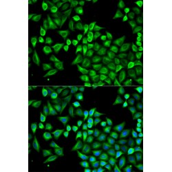 4-Aminobutyrate Aminotransferase (ABAT) Antibody