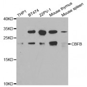 Western blot analysis of extracts of various cell lines, using CBFB antibody (abx004055) at 1/1000 dilution.