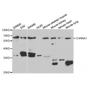 Western blot analysis of extracts of various cell lines, using CHRNA1 antibody (abx004056) at 1/1000 dilution.