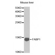 Western blot analysis of extracts of mouse liver, using FABP1 antibody (abx004060) at 1/1000 dilution.