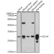 Western blot analysis of extracts of various cell lines, using GCLM antibody (1/1000 dilution).