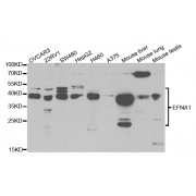 Western blot analysis of extracts of various cell lines, using EFNA1 antibody (abx004083) at 1/1000 dilution.