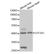 Western blot analysis of extracts of various cell lines, using GTF2A1 antibody (abx004087) at 1/1000 dilution.