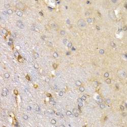 Secreted Frizzled Related Protein 2 (SFRP2) Antibody