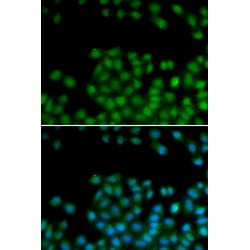 Secreted Frizzled Related Protein 2 (SFRP2) Antibody