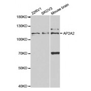 Western blot analysis of extracts of various cell lines, using AP2A2 antibody (abx004129) at 1/1000 dilution.