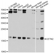 Western blot analysis of extracts of various cell lines, using CETN2 Antibody (abx004132) at 1/1000 dilution.