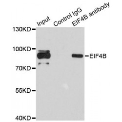 Eukaryotic Translation Initiation Factor 4B (EIF4B) Antibody