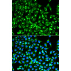 Cell Division Cycle 34 (CDC34) Antibody