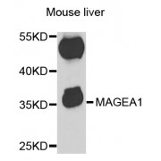 Western blot analysis of extracts of mouse liver, using MAGEA1 antibody (abx004190) at 1/1000 dilution.