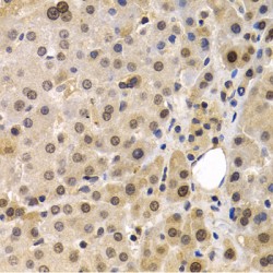 Melanoma-Associated Antigen 1 (MAGEA1) Antibody