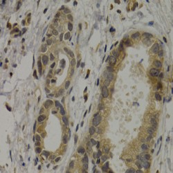 Melanoma-Associated Antigen 1 (MAGEA1) Antibody