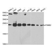 Western blot analysis of extracts of various cell lines, using PSMB2 antibody (abx004200) at 1/1000 dilution.